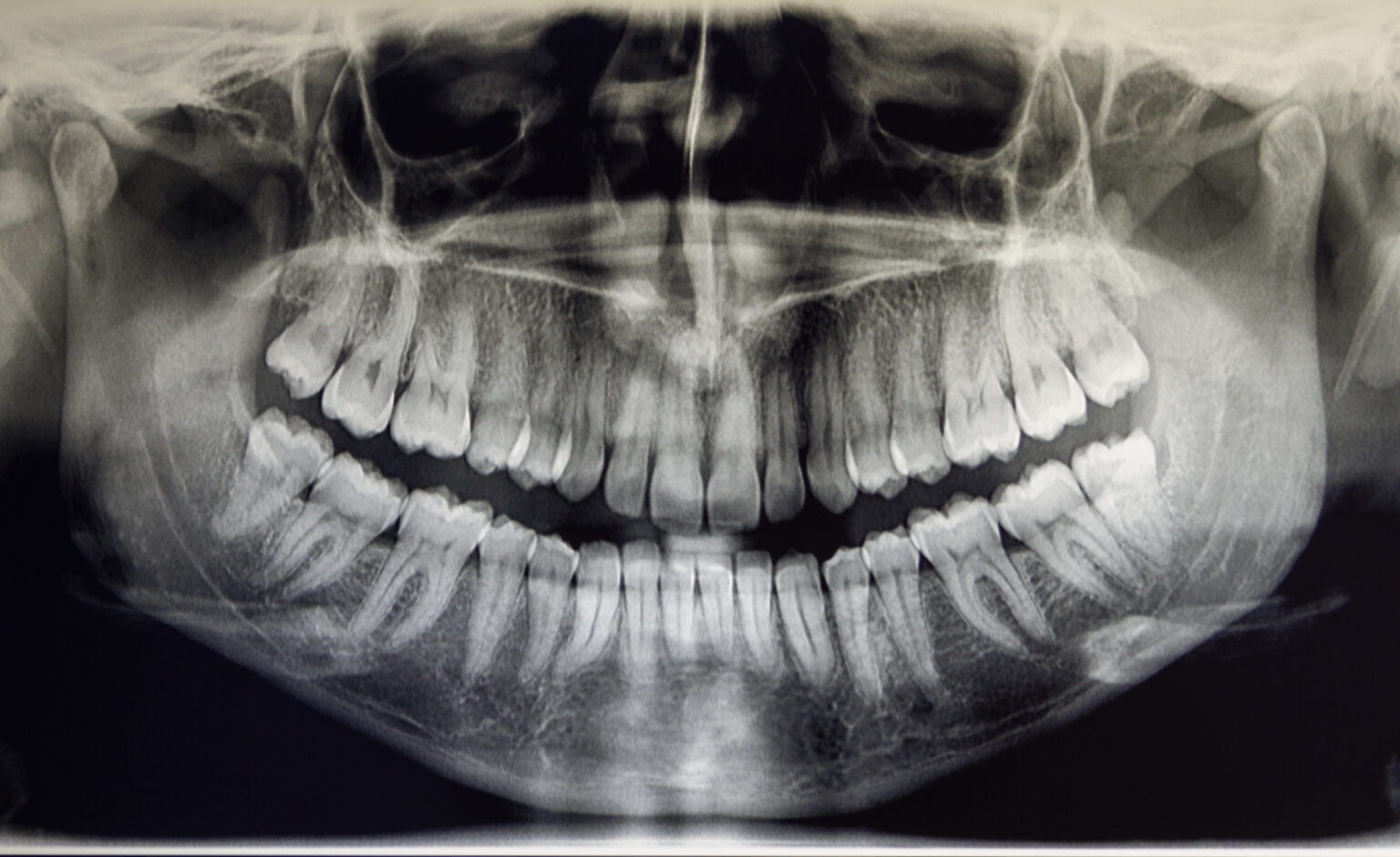 Ideal Alignment and Occlusion Dentist in Salt Lake City, UT